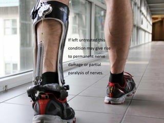 If left untreated this
condition may give rise
to permanent nerve
damage or partial
paralysis of nerves.
 