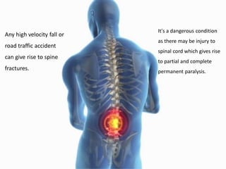 Any high velocity fall or
road traffic accident
can give rise to spine
fractures.
It's a dangerous condition
as there may be injury to
spinal cord which gives rise
to partial and complete
permanent paralysis.
 