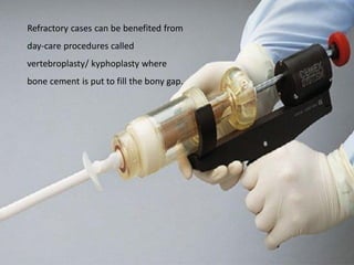 Refractory cases can be benefited from
day-care procedures called
vertebroplasty/ kyphoplasty where
bone cement is put to fill the bony gap.
 