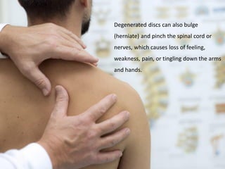 Degenerated discs can also bulge
(herniate) and pinch the spinal cord or
nerves, which causes loss of feeling,
weakness, pain, or tingling down the arms
and hands.
 