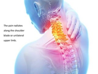 The pain radiates
along the shoulder
blade or unilateral
upper limb.
 
