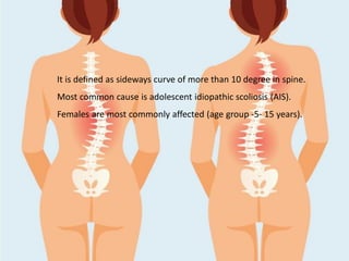 It is defined as sideways curve of more than 10 degree in spine.
Most common cause is adolescent idiopathic scoliosis (AIS).
Females are most commonly affected (age group -5- 15 years).
 
