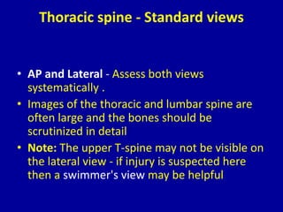 Twining Method Radiography Spine radiography | PPTX