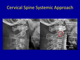 Cervical Spine Systemic Approach
 