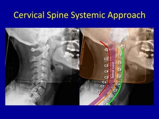 Cervical Spine Systemic Approach
 