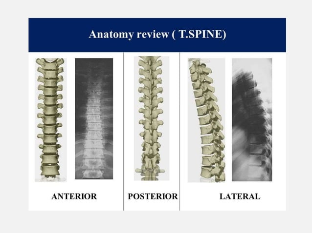 cervical thoracic lumbar sacral Spine Radiography | PPT