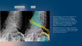 Twining Method Radiography SPINE RADIOLOGY DR JEAN PAUL NKUNDIMANA.pptx