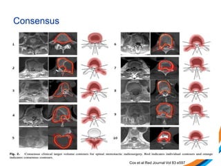 Consensus
Cox et al Red Journal Vol 83 e597
 
