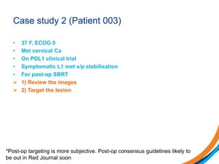 Case study 2 (Patient 003)
• 37 F, ECOG 0
• Met cervical Ca
• On PDL1 clinical trial
• Symptomatic L1 met s/p stabilisation
• For post-op SBRT
 1) Review the images
 2) Target the lesion
*Post-op targeting is more subjective. Post-op consensus guidelines likely to
be out in Red Journal soon
 