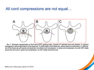 All cord compressions are not equal…
Bilsky et al J Neurosurg: Spine V13 2010
 