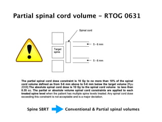 Partial spinal cord volume - RTOG 0631
Spine SBRT Conventional & Partial spinal volumes
 