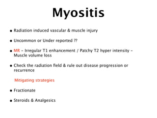 Myositis
• Radiation induced vascular & muscle injury
• Uncommon or Under reported ??
• MR - Irregular T1 enhancement / Patchy T2 hyper intensity -
Muscle volume loss
• Check the radiation ﬁeld & rule out disease progression or
recurrence
Mitigating strategies
• Fractionate
• Steroids & Analgesics
 