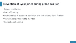 Prevention of Eye injuries during prone position
• Proper positioning
• MAP>70mm Hg
• Maintenance of adequate perfusion pressure with IV fluids /colloids
• Vasopressors if needed to maintain
• Correction of anemia
11
 