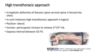 High transthoracic approach
• In kyphotic deformity of thoracic spine cervical spine is forced into
chest.
• In such instances high transthoracic approach is logical.
• Position- lateral.
• Incision- periscapular incision to remove 2nd/3rd rib.
• Exposes interval between C6-T4.
 