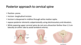 Posterior approach to cervical spine
• Position- prone.
• Incision- longitudinal incision
• Incision is deepened in midline through white median raphe.
• expose posterior elements subperiosteally using electrocautery and elevators.
• While exposing upper cervical spine do not carry dissection farther than 1.5 cm
laterally on either side to avoid vertebral arteries.
 
