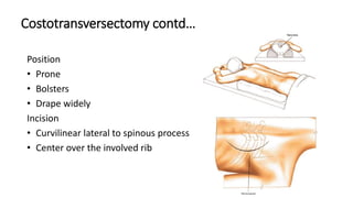 Costotransversectomy contd…
Position
• Prone
• Bolsters
• Drape widely
Incision
• Curvilinear lateral to spinous process
• Center over the involved rib
 