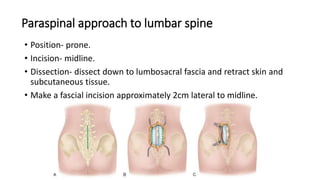 Paraspinal approach to lumbar spine
• Position- prone.
• Incision- midline.
• Dissection- dissect down to lumbosacral fascia and retract skin and
subcutaneous tissue.
• Make a fascial incision approximately 2cm lateral to midline.
 