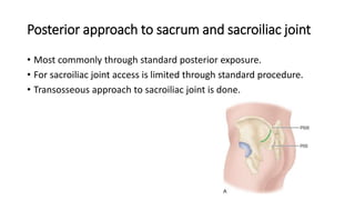 Posterior approach to sacrum and sacroiliac joint
• Most commonly through standard posterior exposure.
• For sacroiliac joint access is limited through standard procedure.
• Transosseous approach to sacroiliac joint is done.
 