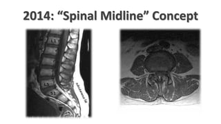 Spine Tracker: A 5-Year Quest to Visualize and Track Posture Data | PPTX
