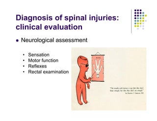 Diagnosis of spinal injuries:
clinical evaluation
Neurological assessment
• Sensation
• Motor function
• Reflexes
• Rectal examination
 