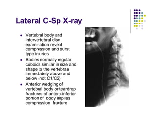 Lateral C-Sp X-ray
Vertebral body and
intervertebral disc
examination reveal
compression and burst
type injuries
Bodies normally regular
cuboids similar in size and
shape to the vertebrae
immediately above and
below (not C1/C2)
Anterior wedging of
vertebral body or teardrop
fractures of antero-inferior
portion of body implies
compression fracture
 