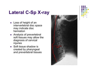 Lateral C-Sp X-ray
Loss of height of an
intervertebral disc space
may indicate disc
herniation
Analysis of prevertebral
soft tissues may allow the
diagnosis of cervical
injuries
Soft tissue shadow is
created by pharyngeal
and prevertebral tissues
 