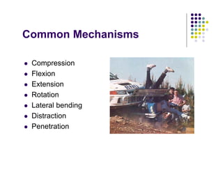 Common Mechanisms
Compression
Flexion
Extension
Rotation
Lateral bending
Distraction
Penetration
 