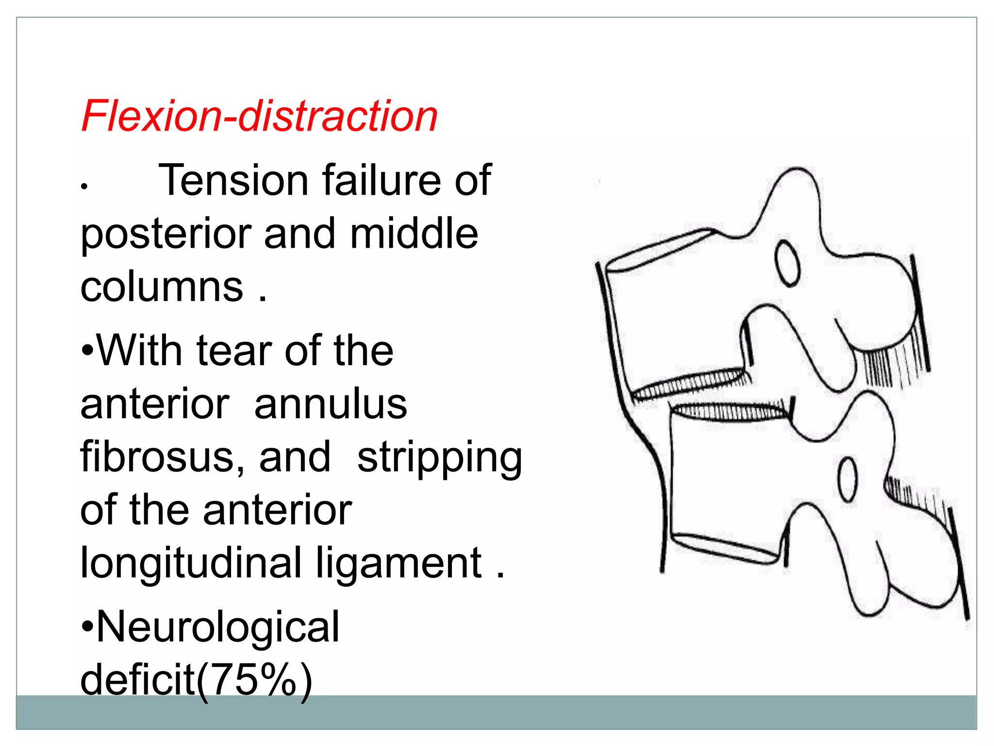 Flexion-distraction
• Tension failure of
posterior and middle
columns .
•With tear of the
anterior annulus
fibrosus, and stripping
of the anterior
longitudinal ligament .
•Neurological
deficit(75%)
 