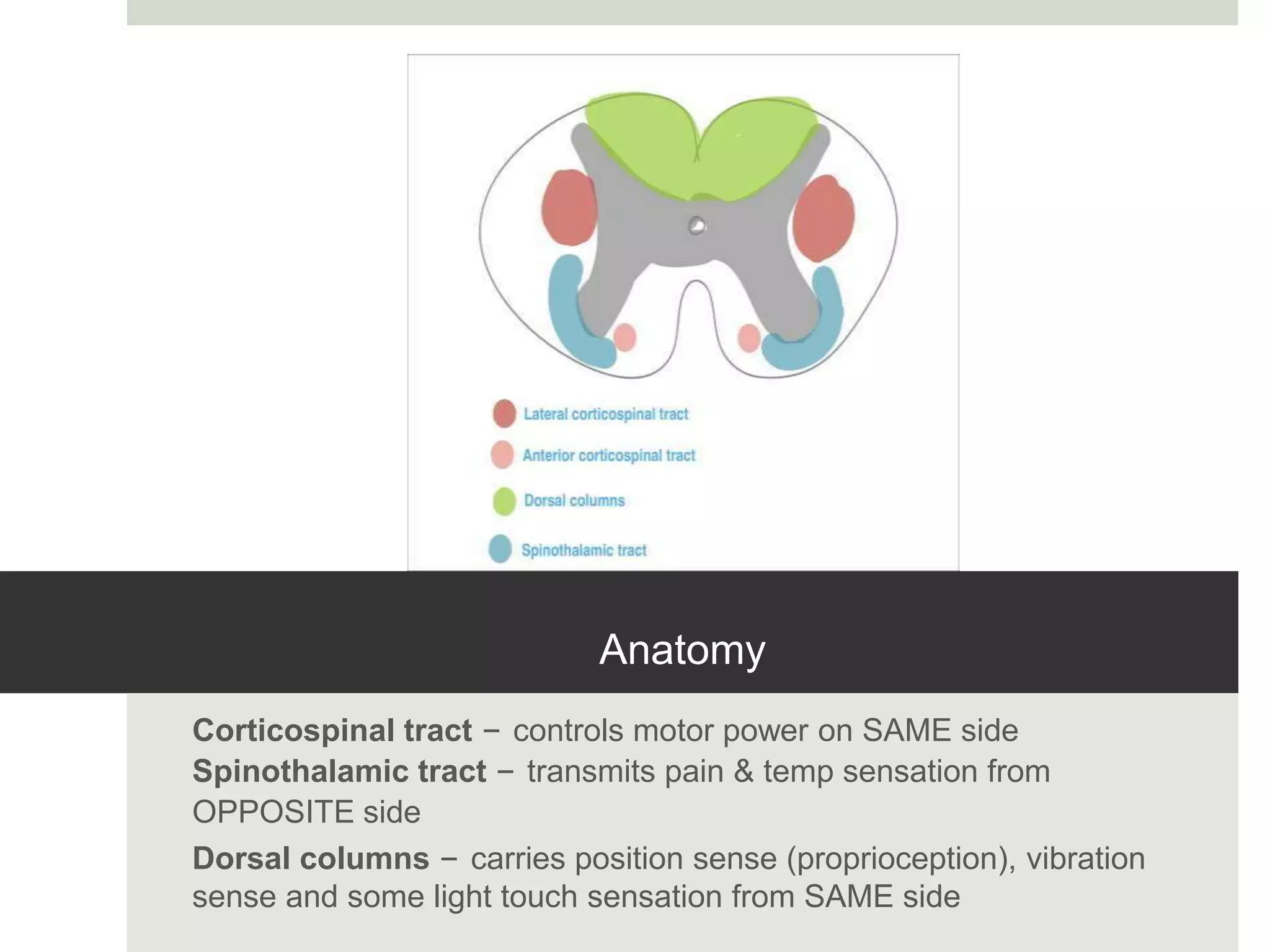 Anatomy
Corticospinal tract – controls motor power on SAME side
Spinothalamic tract – transmits pain & temp sensation from
OPPOSITE side
Dorsal columns – carries position sense (proprioception), vibration
sense and some light touch sensation from SAME side
 