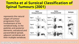 Comprehensive Approach to Diagnosis and Management of Spinal Tumours | PPTX