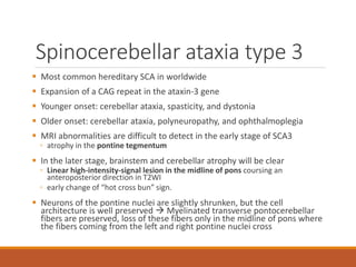 Spinocerebellar ataxia | PDF
