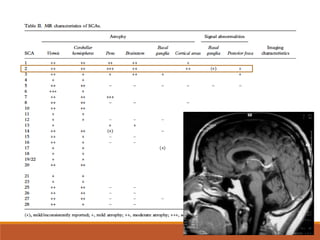 Spinocerebellar ataxia | PDF