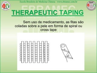 Taping - Bandagem Elástica Terapêuticas | PDF