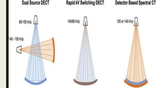 Msct System Spiral helical, mSCT MDCT, Dual source ct, EBCT, CBCT, portable CT.pptx