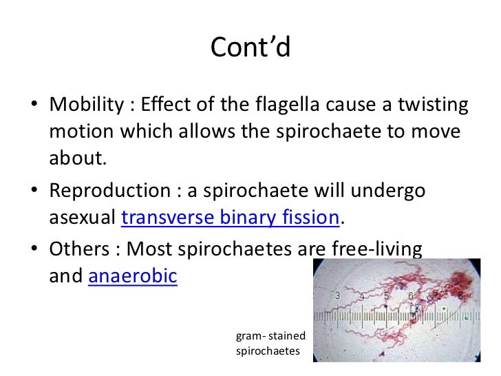 Spirillum Volutans Causes What Disease - Quotes Viral