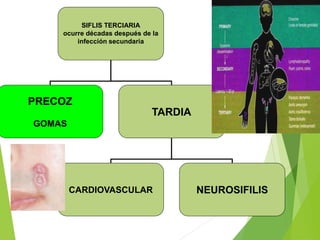 SIFLIS TERCIARIA
ocurre décadas después de la
infección secundaria
PRECOZ
GOMAS
TARDIA
CARDIOVASCULAR NEUROSIFILIS
 