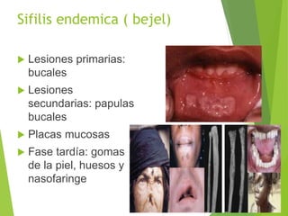 Sifilis endemica ( bejel)
 Lesiones primarias:
bucales
 Lesiones
secundarias: papulas
bucales
 Placas mucosas
 Fase tardía: gomas
de la piel, huesos y
nasofaringe
 