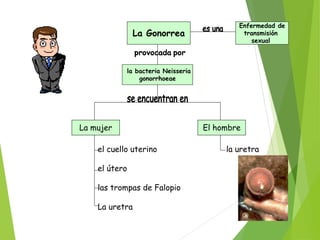 La Gonorrea
Enfermedad de
transmisión
sexual
la bacteria Neisseria
gonorrhoeae
La mujer El hombre
el cuello uterino
el útero
las trompas de Falopio
La uretra
la uretra
 