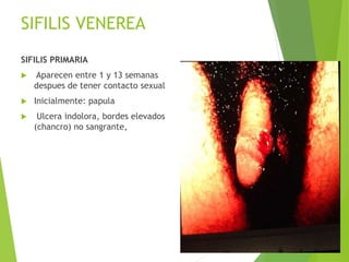 SIFILIS VENEREA
SIFILIS PRIMARIA
 Aparecen entre 1 y 13 semanas
despues de tener contacto sexual
 Inicialmente: papula
 Ulcera indolora, bordes elevados
(chancro) no sangrante,
 