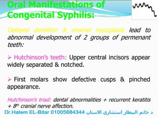 Oral Manifestations of
Congenital Syphilis:
Delayed dentition & enamel hypoplasia lead to
abnormal development of 2 groups of permenant
teeth:
 Hutchinson’s teeth: Upper central incisors appear
widely separated & notched.
 First molars show defective cusps & pinched
appearance.
Hutchinson’s triad: dental abnormalities + recurrent keratitis
+ 8th cranial nerve affection.
 
