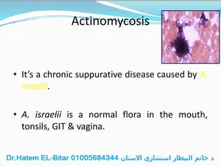 Actinomycosis
• It’s a chronic suppurative disease caused by A.
israelii.
• A. israelii is a normal flora in the mouth,
tonsils, GIT & vagina.
 