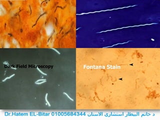 Dark Field Microscopy Fontana Stain
 