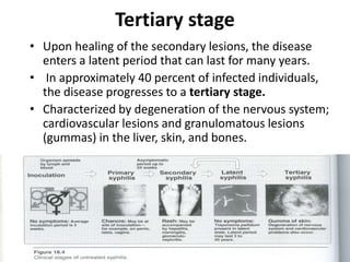 Tertiary stage
• Upon healing of the secondary lesions, the disease
enters a latent period that can last for many years.
• In approximately 40 percent of infected individuals,
the disease progresses to a tertiary stage.
• Characterized by degeneration of the nervous system;
cardiovascular lesions and granulomatous lesions
(gummas) in the liver, skin, and bones.
 