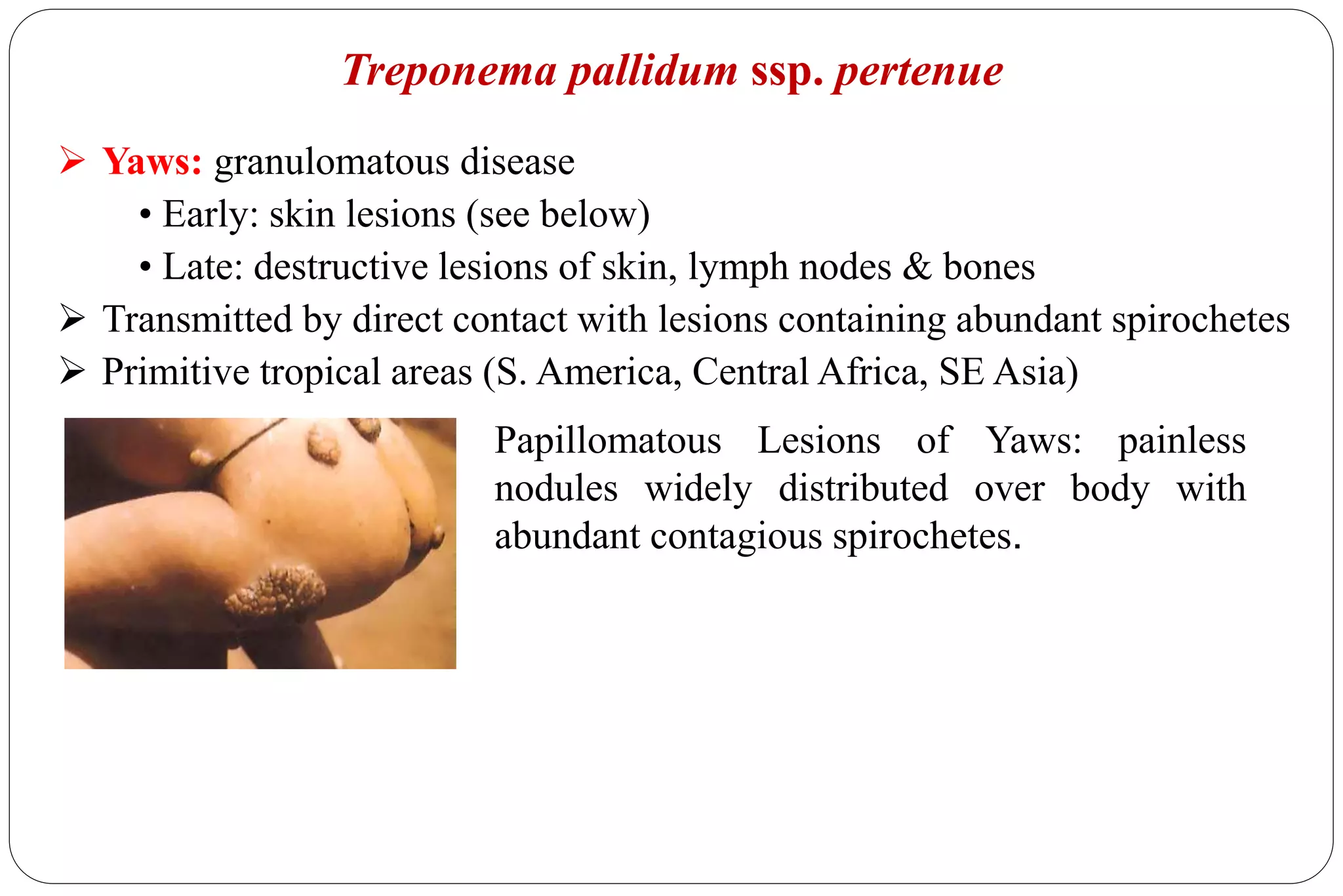 Treponema pallidum ssp. pertenue
Papillomatous Lesions of Yaws: painless
nodules widely distributed over body with
abundant contagious spirochetes.
 Yaws: granulomatous disease
• Early: skin lesions (see below)
• Late: destructive lesions of skin, lymph nodes & bones
 Transmitted by direct contact with lesions containing abundant spirochetes
 Primitive tropical areas (S. America, Central Africa, SE Asia)
 