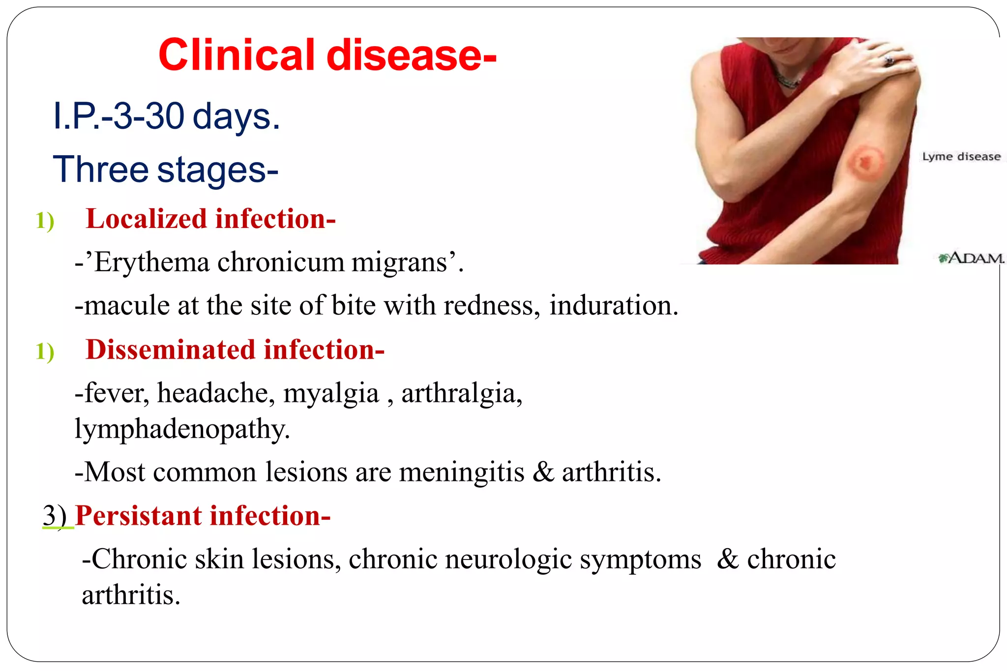 Clinical disease-
I.P.-3-30 days.
Three stages-
1) Localized infection-
-’Erythema chronicum migrans’.
-macule at the site of bite with redness, induration.
1) Disseminated infection-
-fever, headache, myalgia , arthralgia,
lymphadenopathy.
-Most common lesions are meningitis & arthritis.
3) Persistant infection-
-Chronic skin lesions, chronic neurologic symptoms & chronic
arthritis.
 