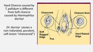 Hard Chancre caused by
T. pallidum is different
from Soft chancre
caused by Haemophilus
ducreyi
(H. ducreyi causes a
non-indurated, purulent,
soft lesion “chanceroid”)
 