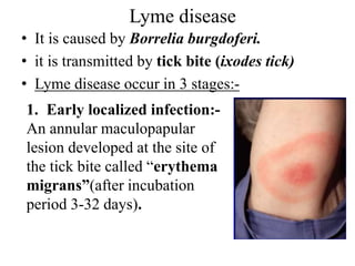 Spirochetes.pptx