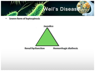 Weil’s Disease

 