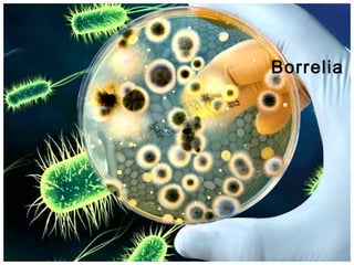 Borrelia

 