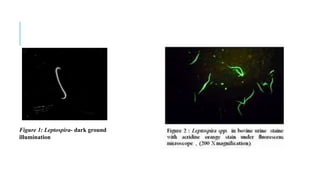 Figure 1: Leptospira- dark ground
illumination
 